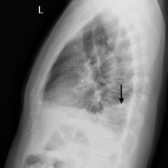 Creative Commons images