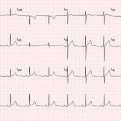 Creative Commons images