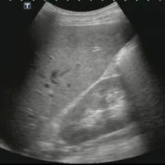 Creative Commons images