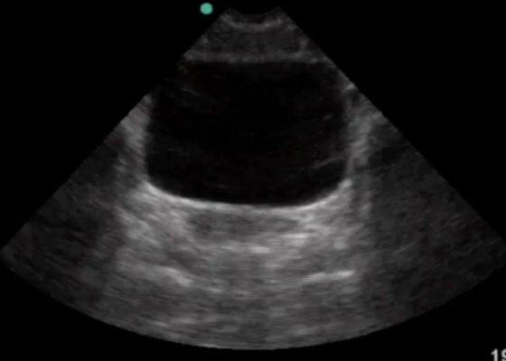 Creative Commons images