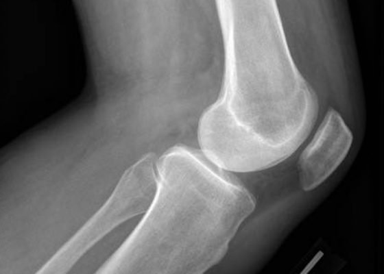 Creative Commons images