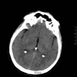 Creative Commons images