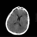 Creative Commons images