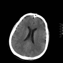 Creative Commons images