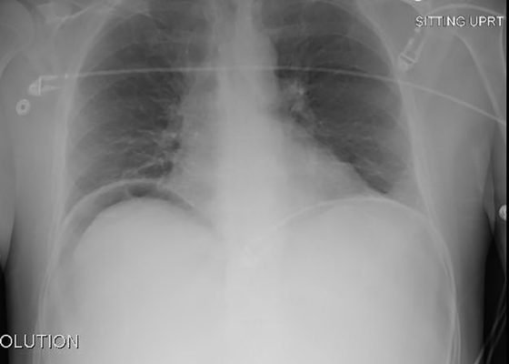 Creative Commons images