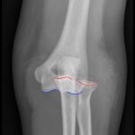 Creative Commons images