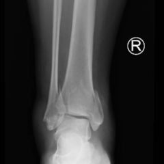 Creative Commons images