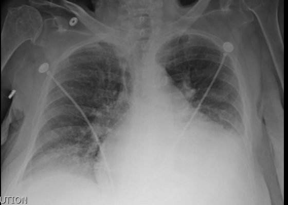 Creative Commons images