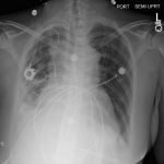 Creative Commons images