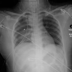 Creative Commons images