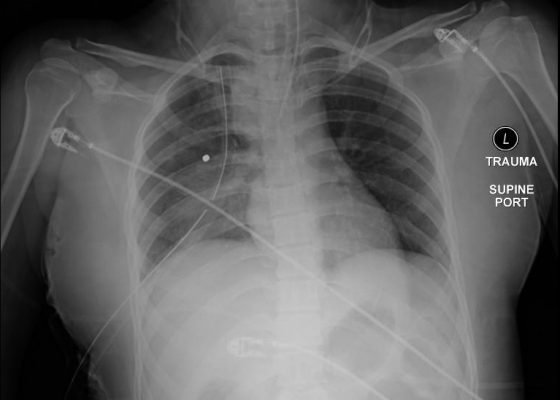 Creative Commons images