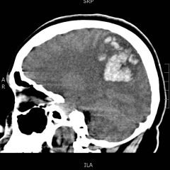 Creative Commons images