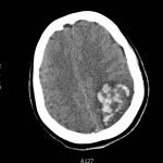 Creative Commons images