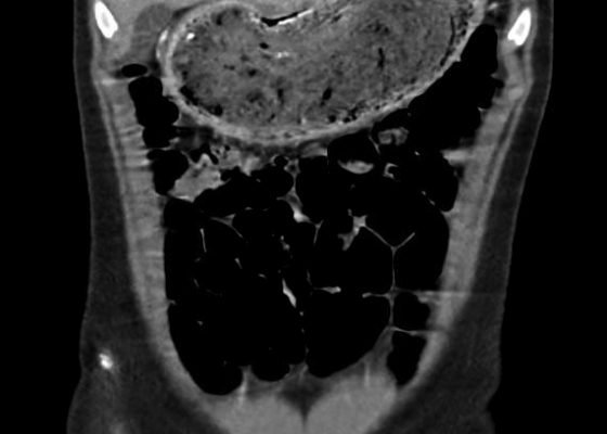 Creative Commons images