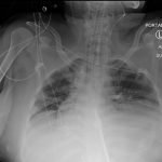 Creative Commons images