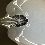 Creative Commons images