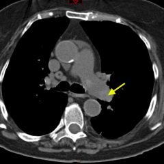 Creative Commons images