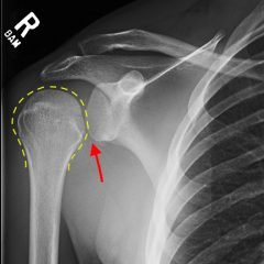 Creative Commons images