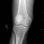 Creative Commons images