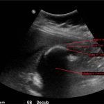 Creative Commons images