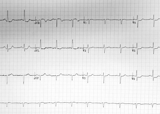 Creative Commons images