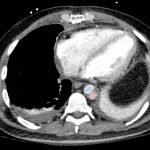 Creative Commons images