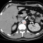 Creative Commons images