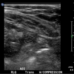 Creative Commons images