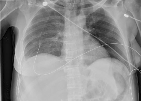 Creative Commons images