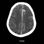 Creative Commons images