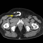 Creative Commons images