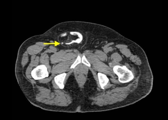 Creative Commons images