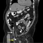 Creative Commons images