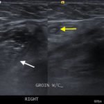 Creative Commons images