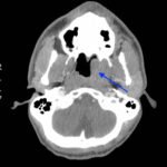 Creative Commons images