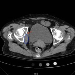 Creative Commons images