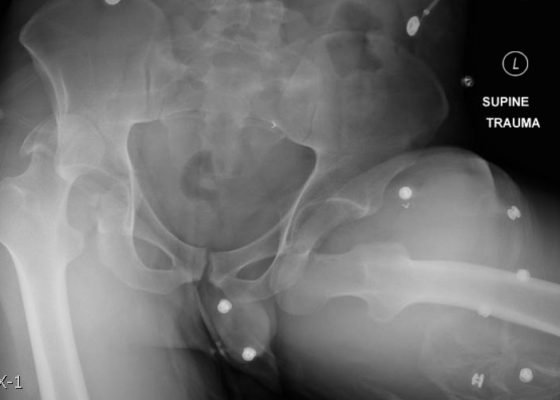 Creative Commons images