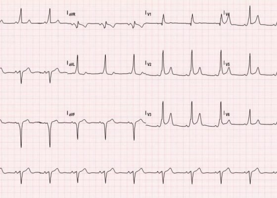 Creative Commons images