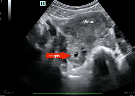 Creative Commons images