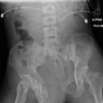 Creative Commons images