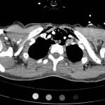 Creative Commons images