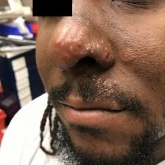 Creative Commons images