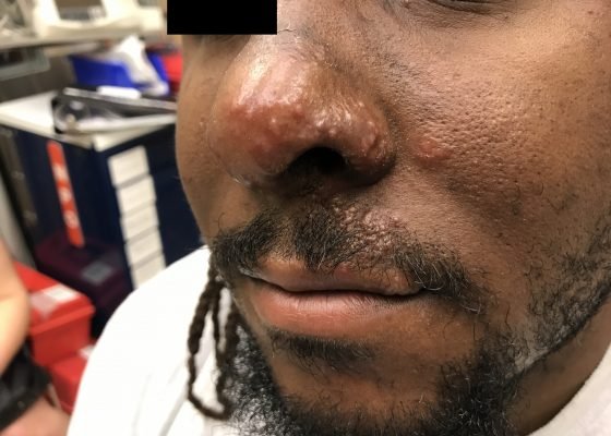 Creative Commons images
