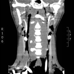 Creative Commons images