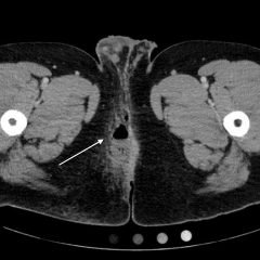 Creative Commons images