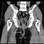 Creative Commons images