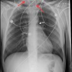 Creative Commons images