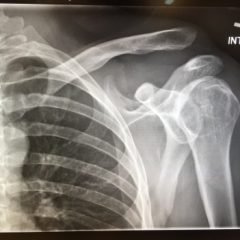 Creative Commons images