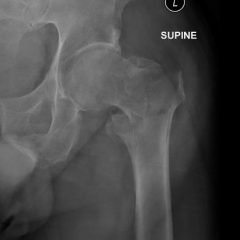 Creative Commons images