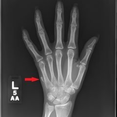 Creative Commons images